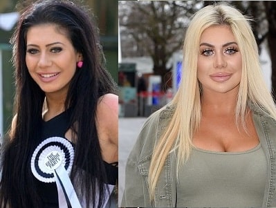 A picture of Chloe Ferry before (left) and after (right) breast augmentation procedure.
